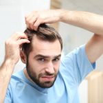 perte des cheveux