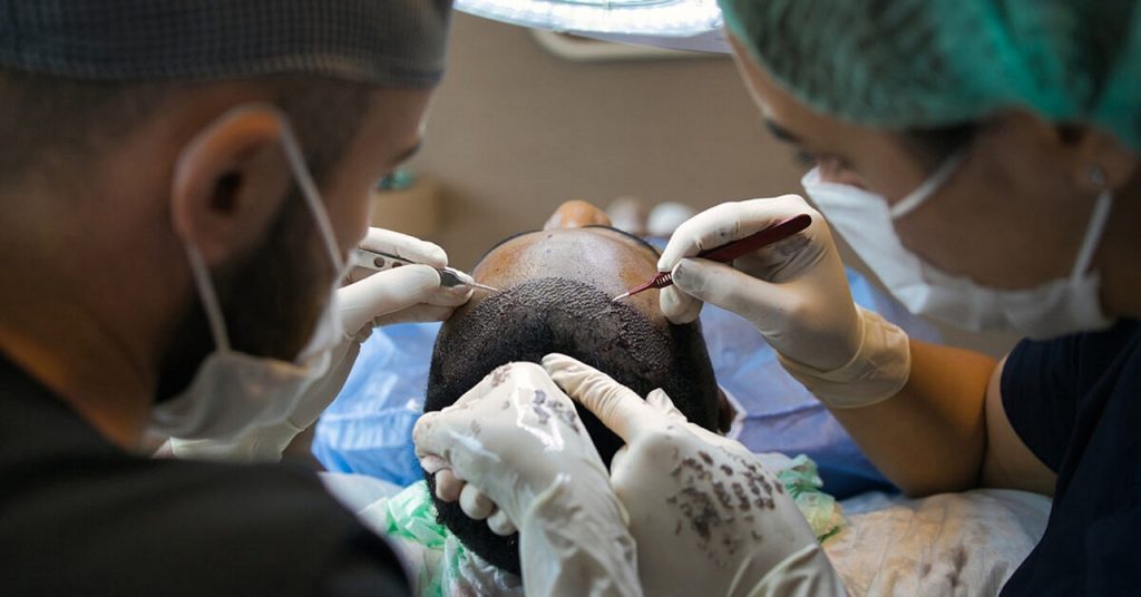 opération de cheveux en turquie