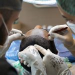 opération de cheveux en turquie