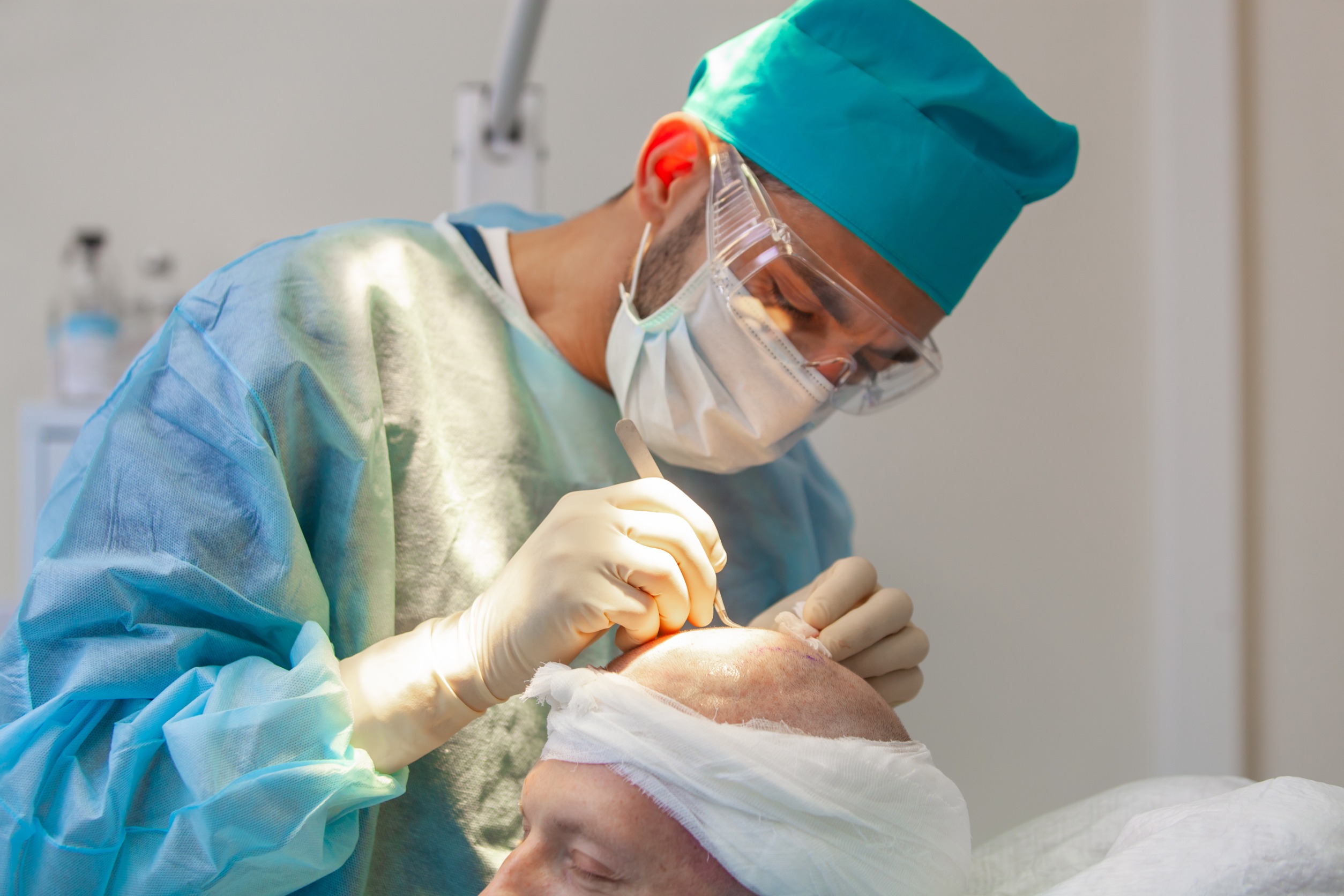 Greffe capillaire en Turquie : Prix abordables pour une solution de qualité
