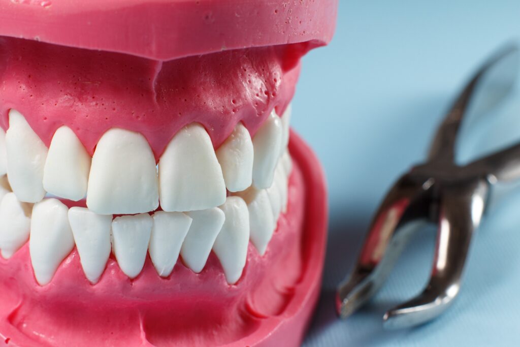 Comment éliminer le sourire gingival et transformer votre sourire ?