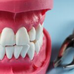 Comment éliminer le sourire gingival et transformer votre sourire ?