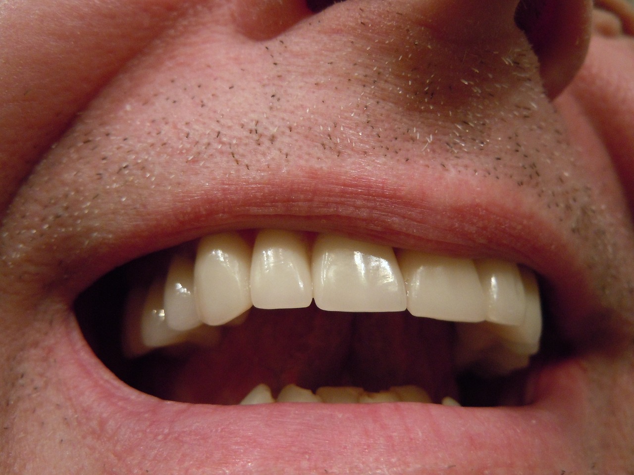 Quelles sont les conséquences d’une dent dévitalisée ? On vous dit tout !