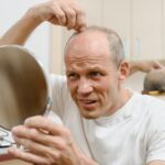 Greffe des cheveux : inflammation zone donneuse et réaction à avoir !