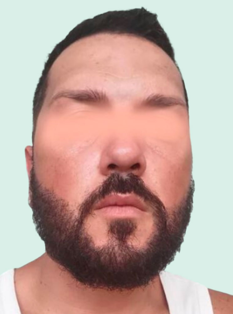 AP