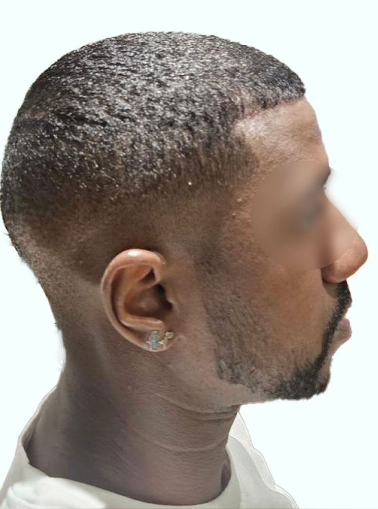 AV