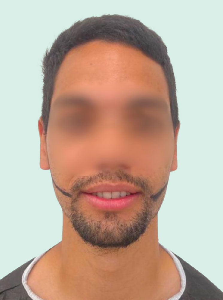 AV