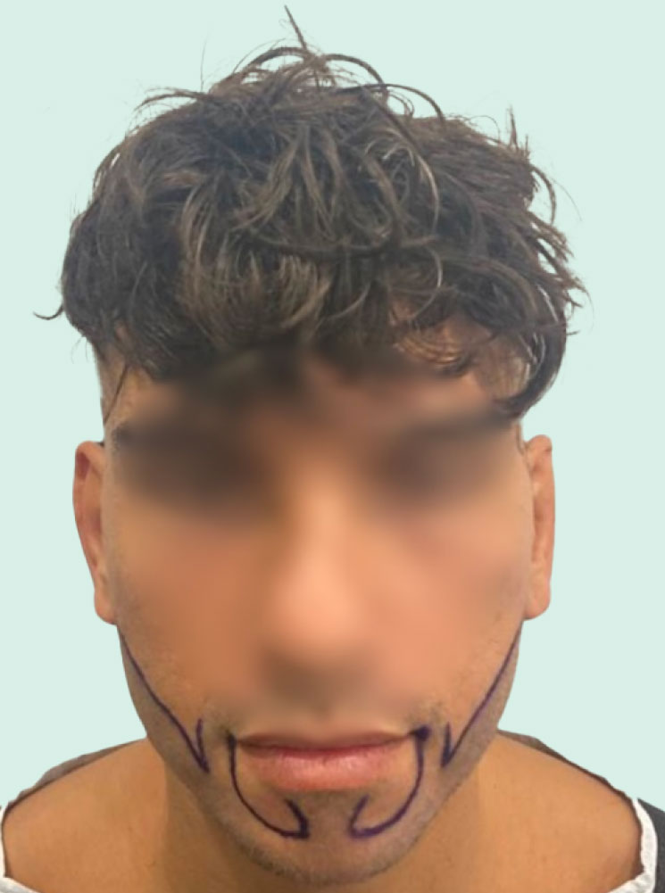 AV