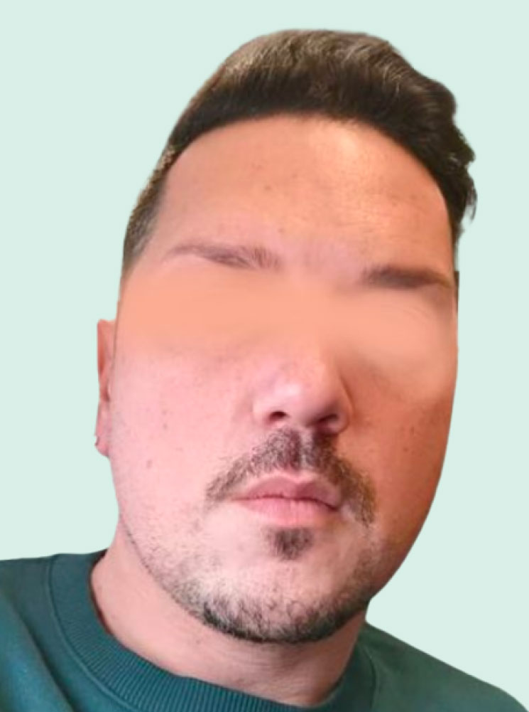 AV
