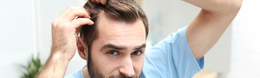 perte des cheveux